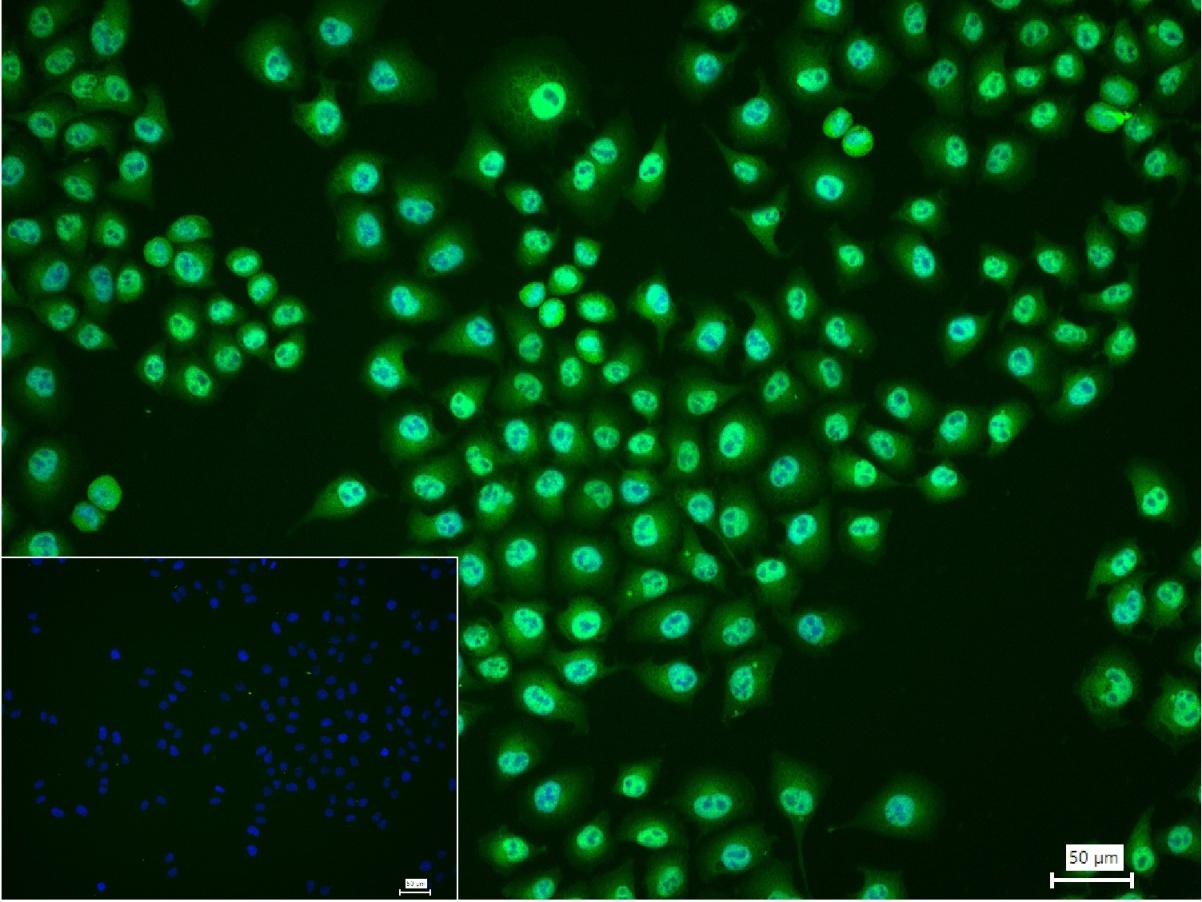 肿瘤坏死因子α诱导蛋白3重组兔单抗