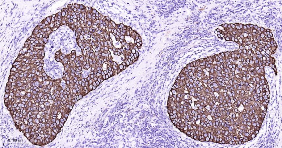 细胞角蛋白8重组兔单抗