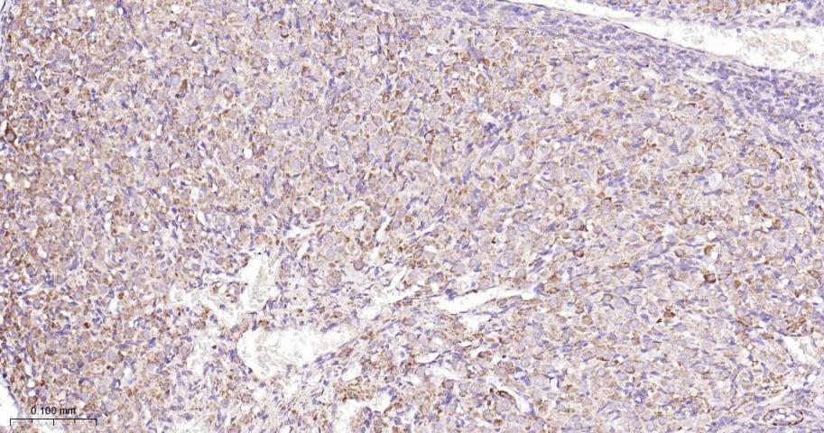 铬细胞瘤患者抑癌基因SDHB重组兔单抗