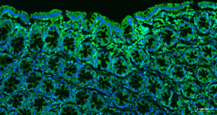 β-肌动蛋白/β-Actin（内参）单克隆抗体-bsm-33036M