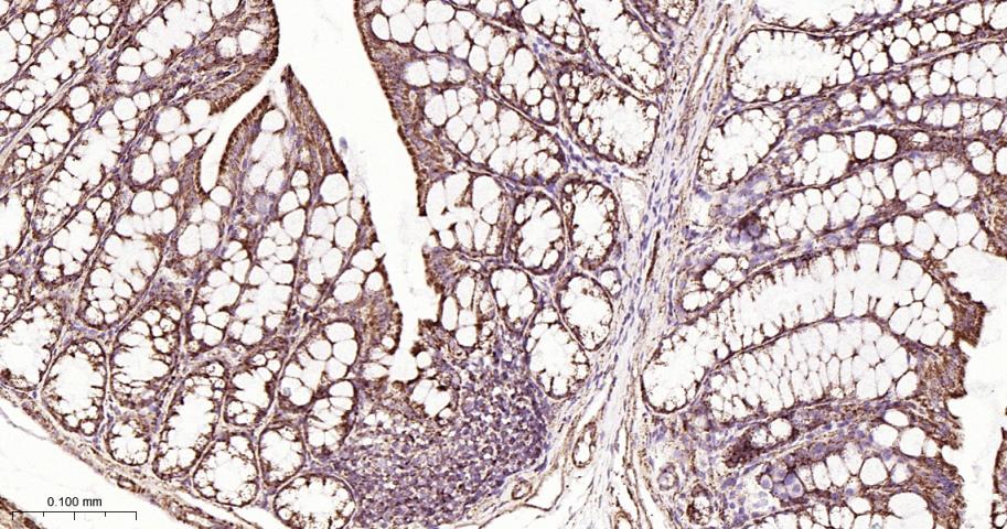 铬细胞瘤患者抑癌基因SDHB重组兔单抗