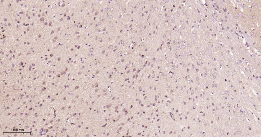 B Raf重组兔单抗