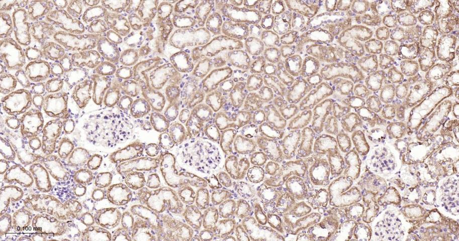 铬细胞瘤患者抑癌基因SDHB重组兔单抗