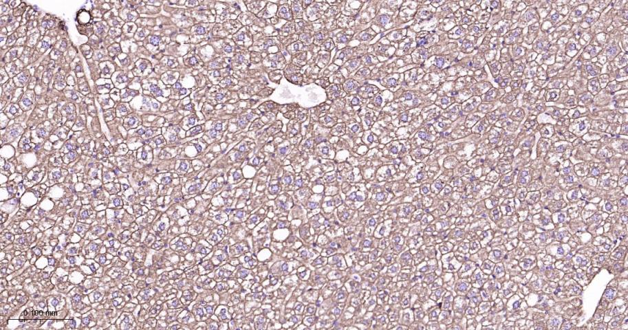 细胞角蛋白8重组兔单抗