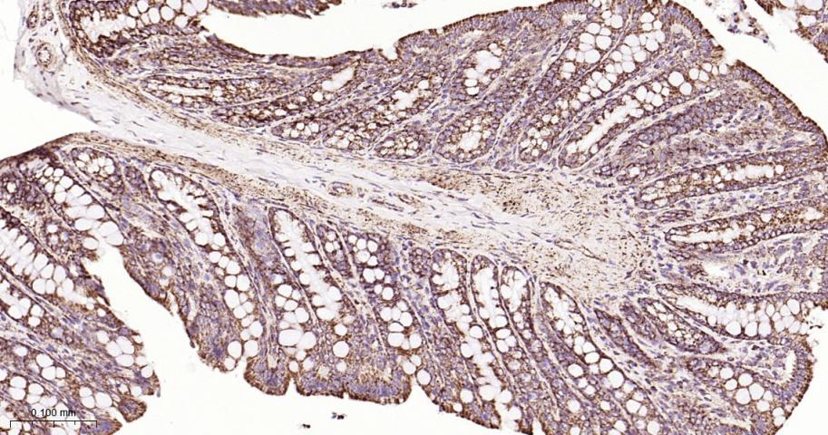 铬细胞瘤患者抑癌基因SDHB重组兔单抗