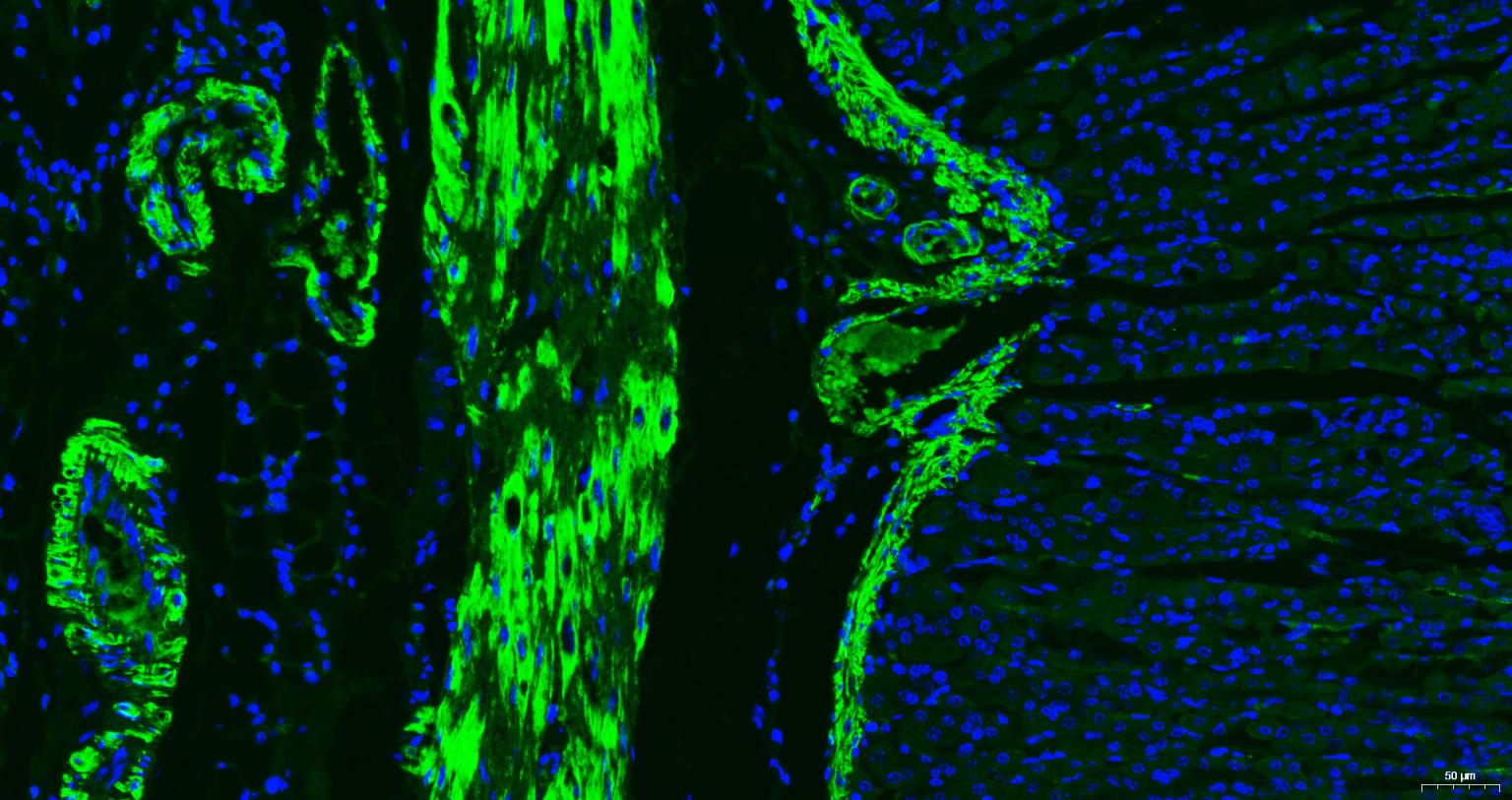 肌动蛋白α/α-SMA/α Actin单克隆抗体-bsm-33187M
