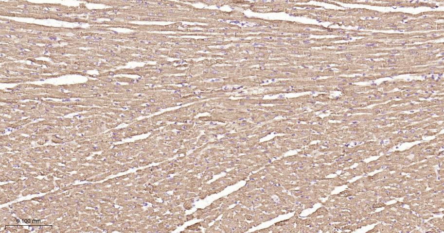 铬细胞瘤患者抑癌基因SDHB重组兔单抗