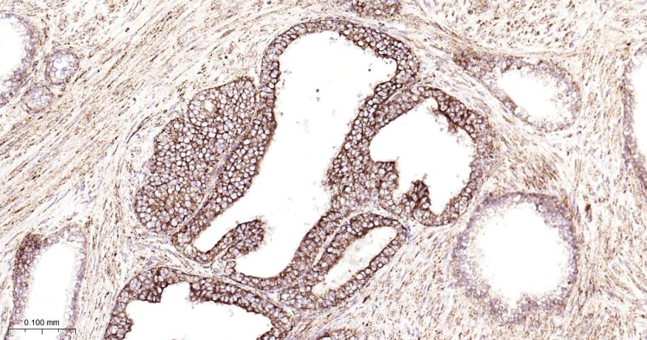 铬细胞瘤患者抑癌基因SDHB重组兔单抗