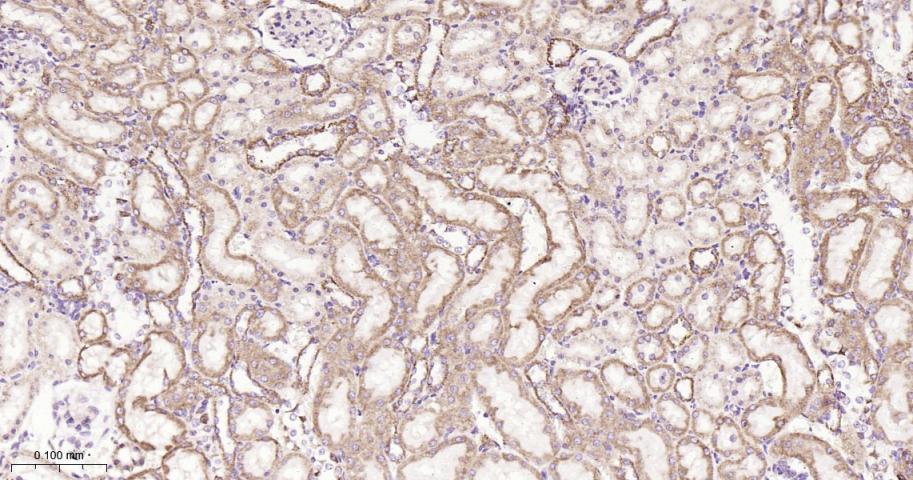 铬细胞瘤患者抑癌基因SDHB重组兔单抗