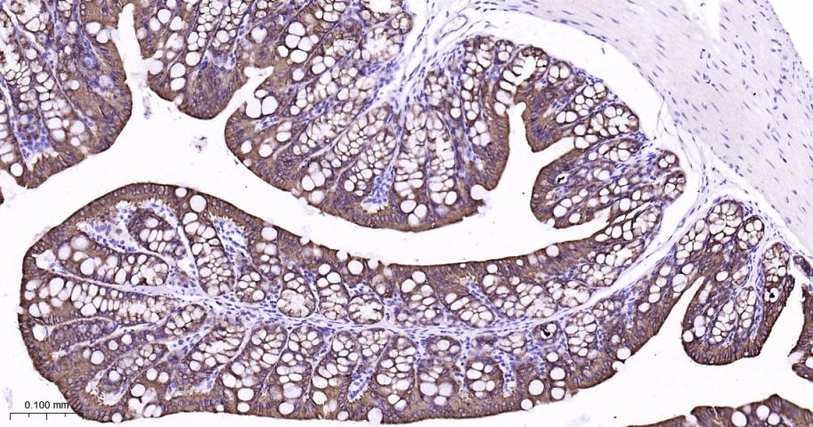 细胞角蛋白8重组兔单抗