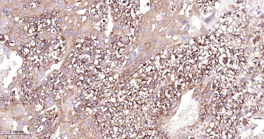 B Raf重组兔单抗