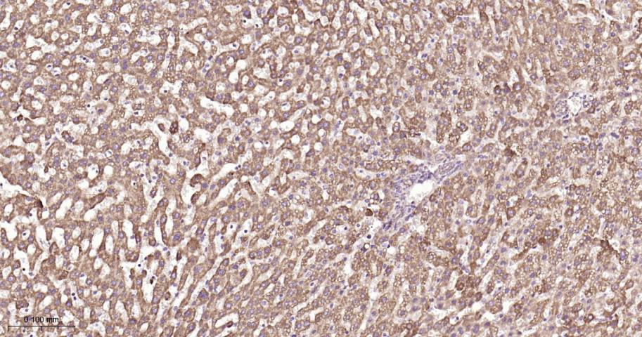 铬细胞瘤患者抑癌基因SDHB重组兔单抗