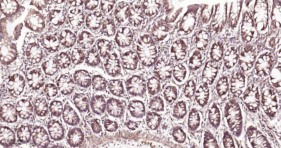 铬细胞瘤患者抑癌基因SDHB重组兔单抗