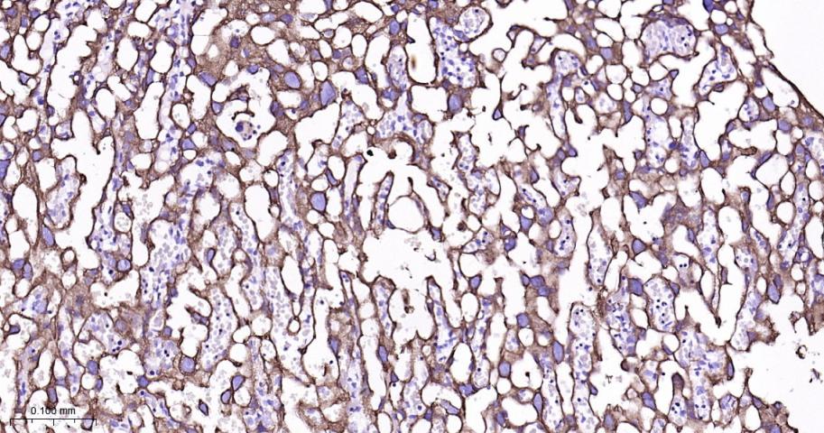 细胞角蛋白8重组兔单抗
