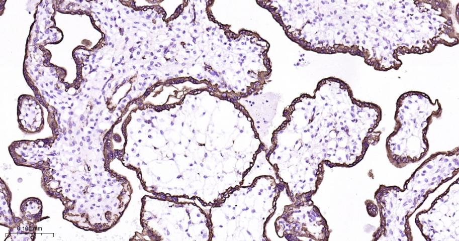 细胞角蛋白8重组兔单抗