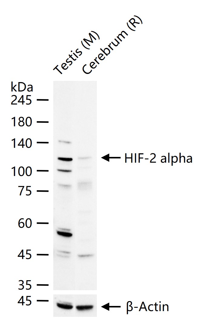 缺氧诱导因子2α /EPAS1抗体-bs-1447R