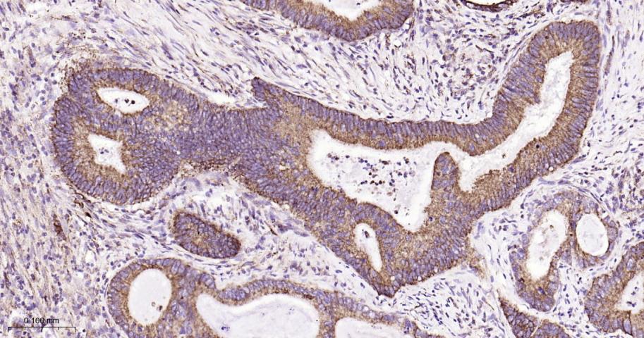 铬细胞瘤患者抑癌基因SDHB重组兔单抗