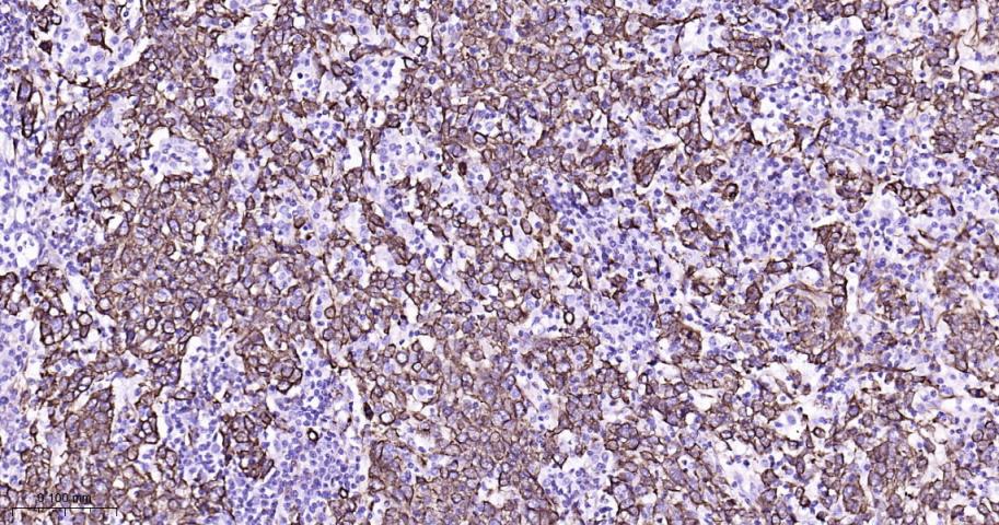 细胞角蛋白8重组兔单抗