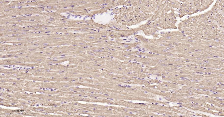 铬细胞瘤患者抑癌基因SDHB重组兔单抗