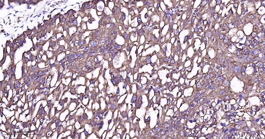 细胞角蛋白8重组兔单抗