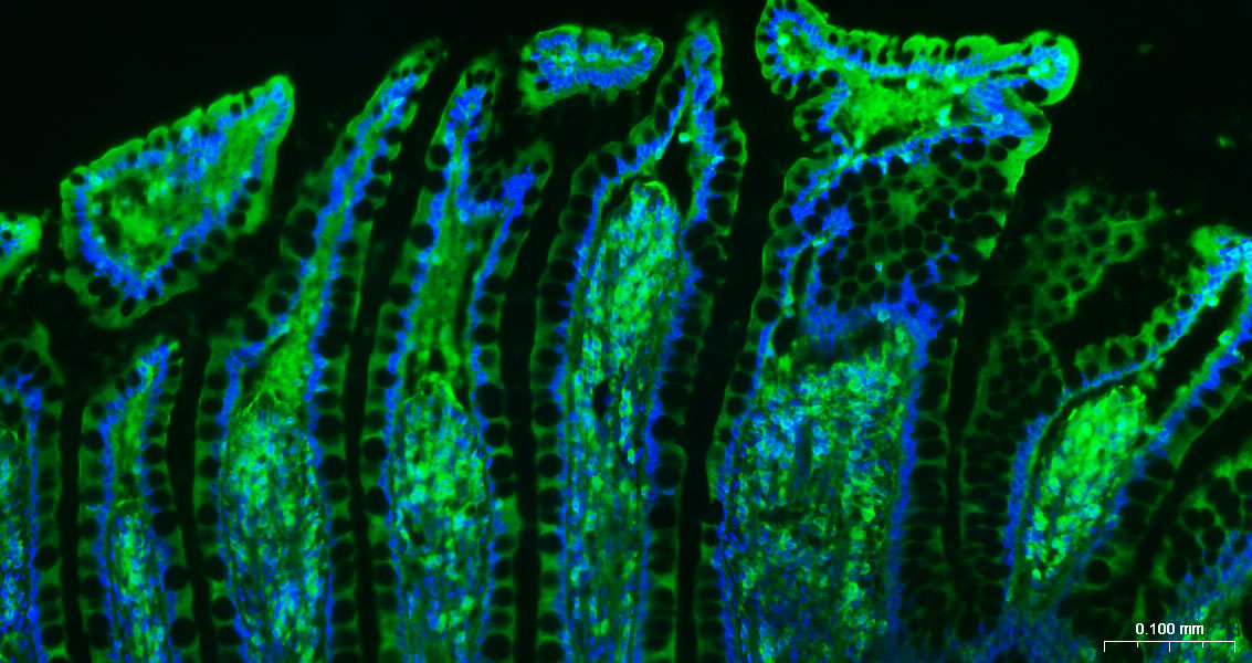 β-肌动蛋白/β-Actin（内参）单克隆抗体-bsm-33036M