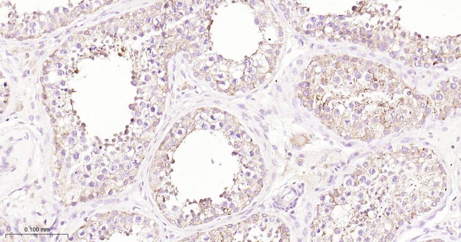 B Raf重组兔单抗