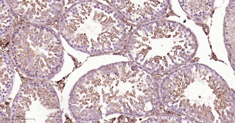 B Raf重组兔单抗