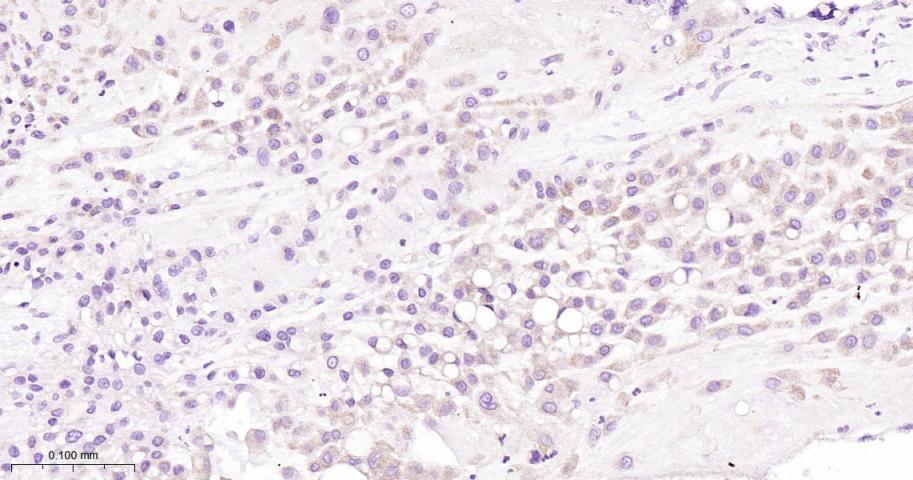 B Raf重组兔单抗