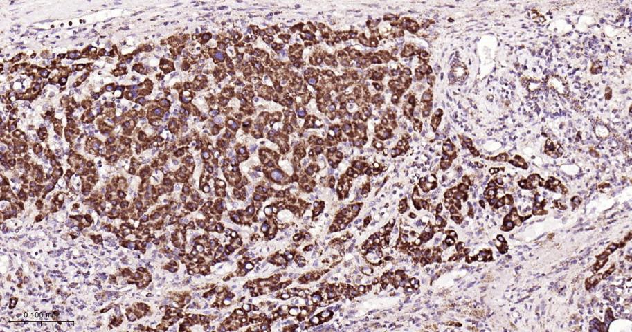 铬细胞瘤患者抑癌基因SDHB重组兔单抗