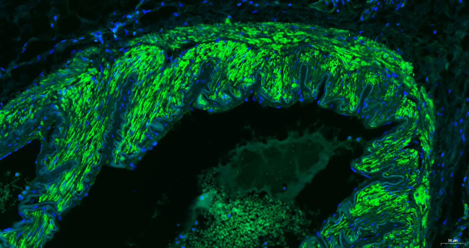 肌动蛋白α/α-SMA/α Actin单克隆抗体-bsm-33187M