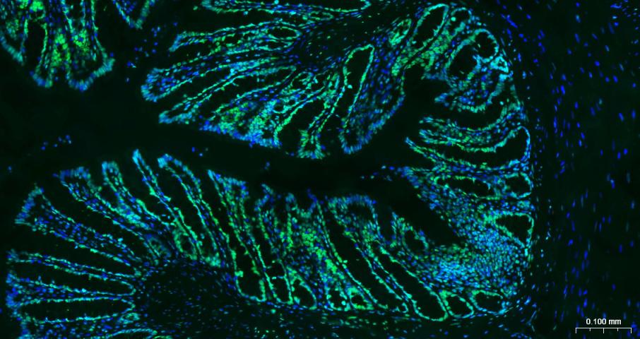 核纤层蛋白B（核内参）单克隆抗体-bsm-33040M