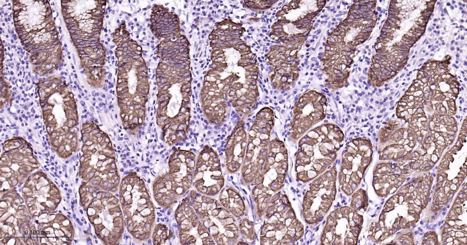 细胞角蛋白8重组兔单抗