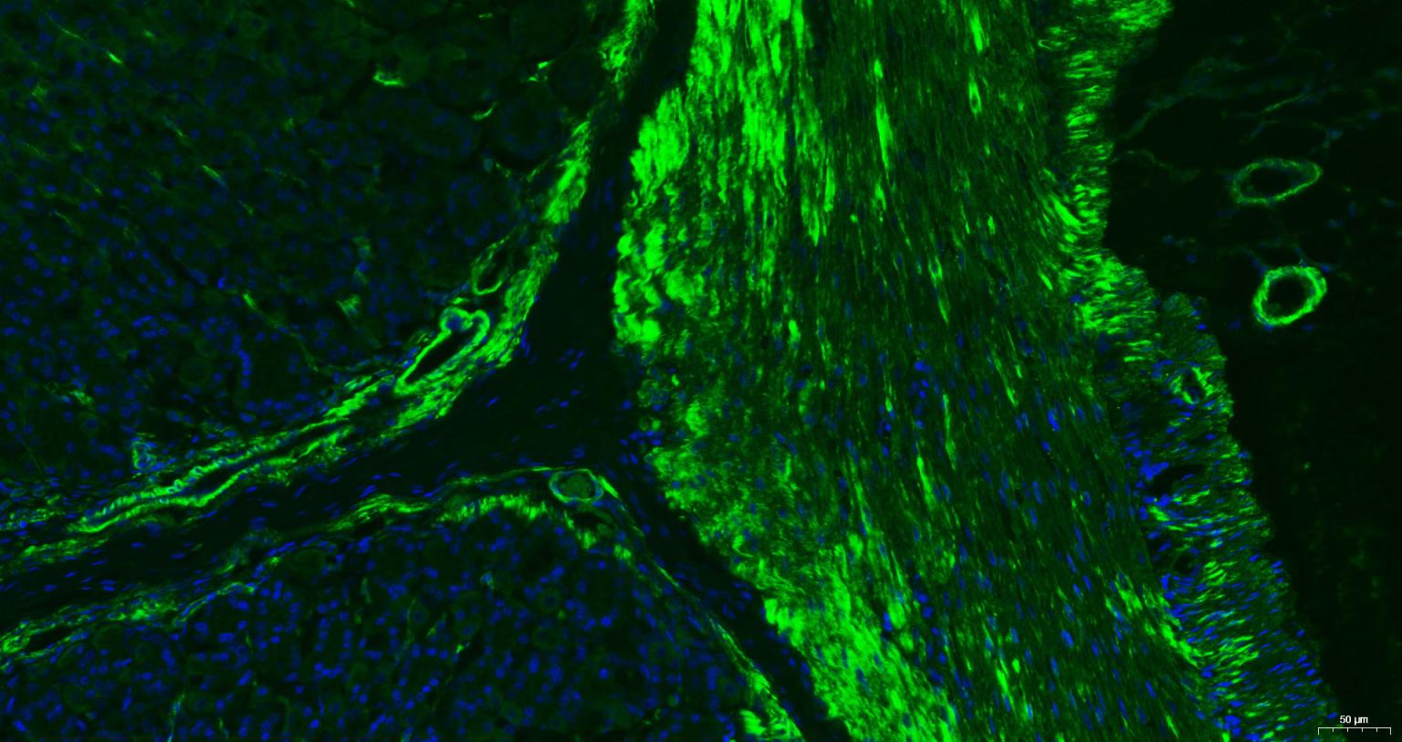 肌动蛋白α/α-SMA/α Actin单克隆抗体-bsm-33187M