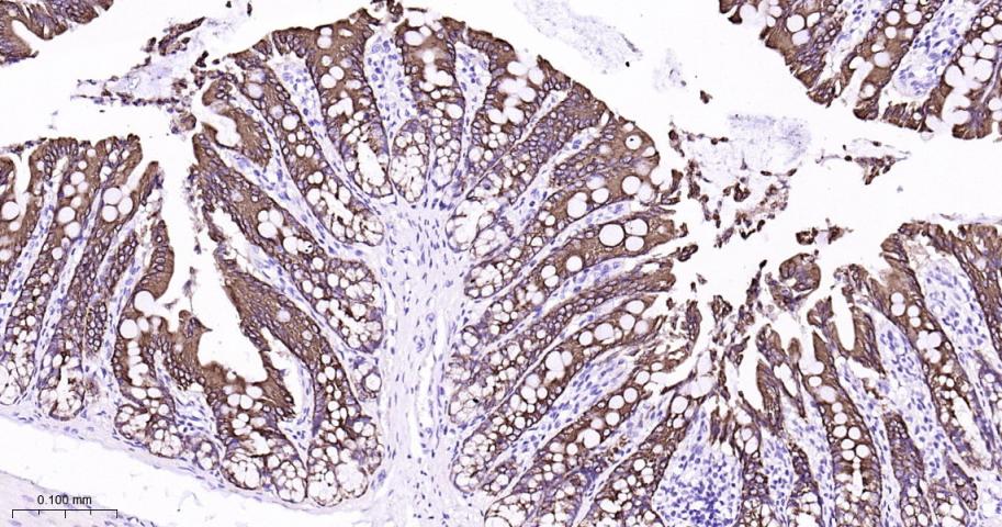 细胞角蛋白8重组兔单抗