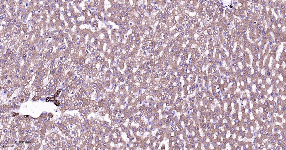 细胞角蛋白8重组兔单抗