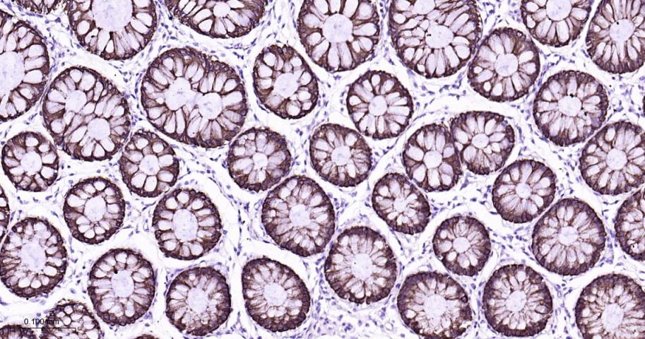 细胞角蛋白8重组兔单抗