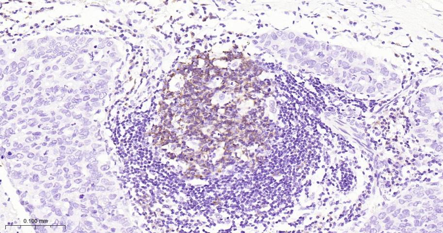 胰岛素样生长因子2mRNA结合蛋白3重组兔单抗