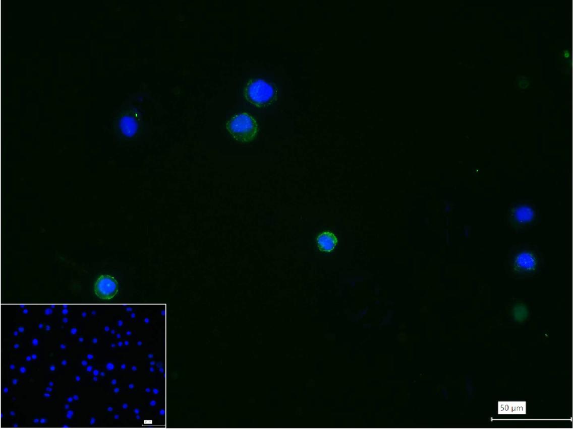CD20 Rabbit pAb (一抗) | Bioss