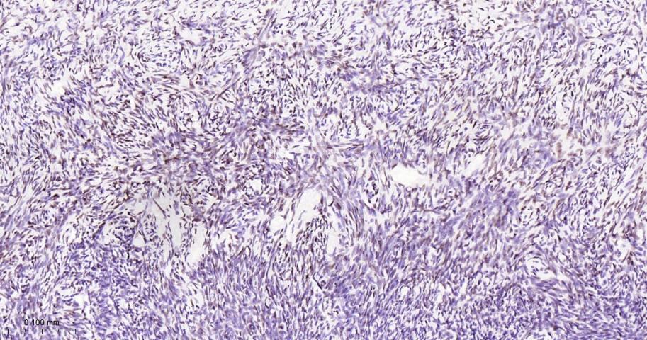 叉头蛋白L2抗体