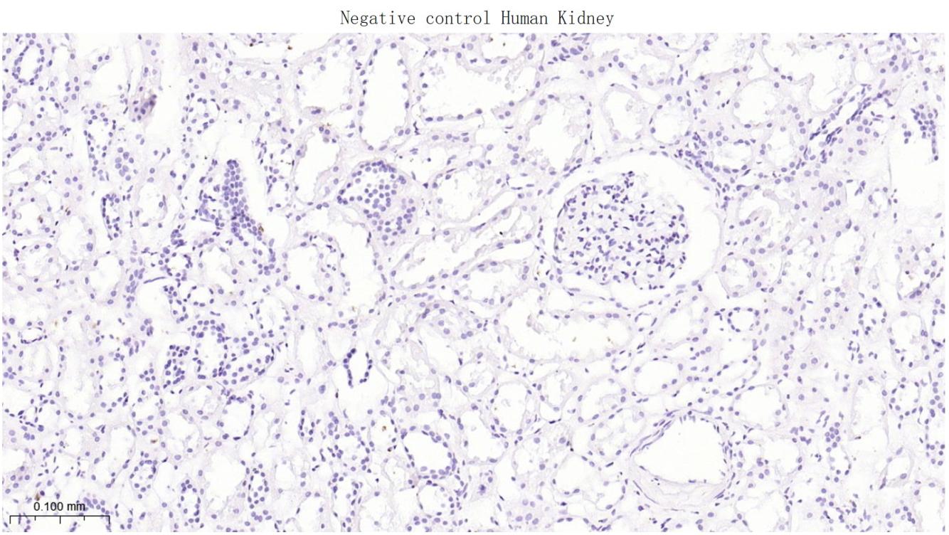 胰岛素样生长因子2mRNA结合蛋白3重组兔单抗