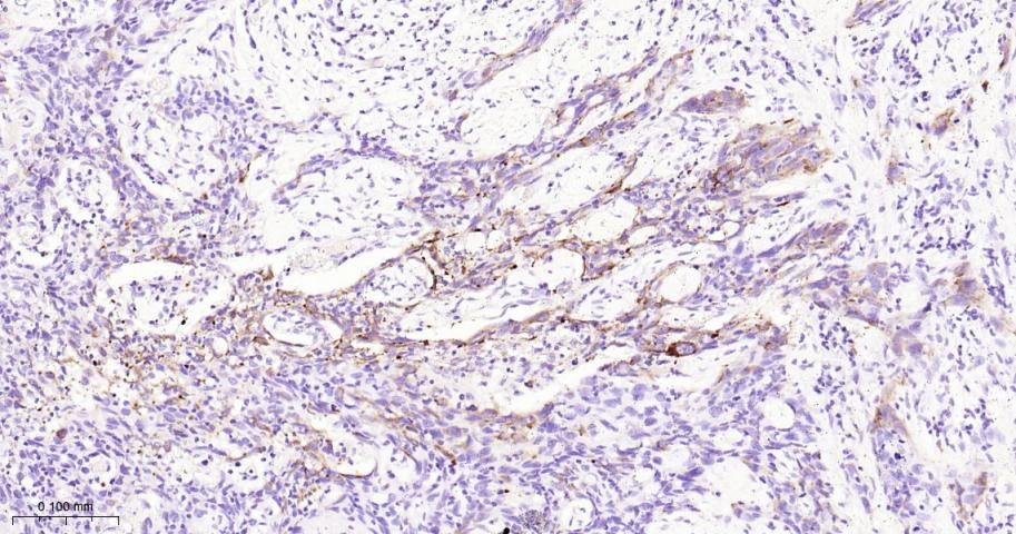 胰岛素样生长因子2mRNA结合蛋白3重组兔单抗