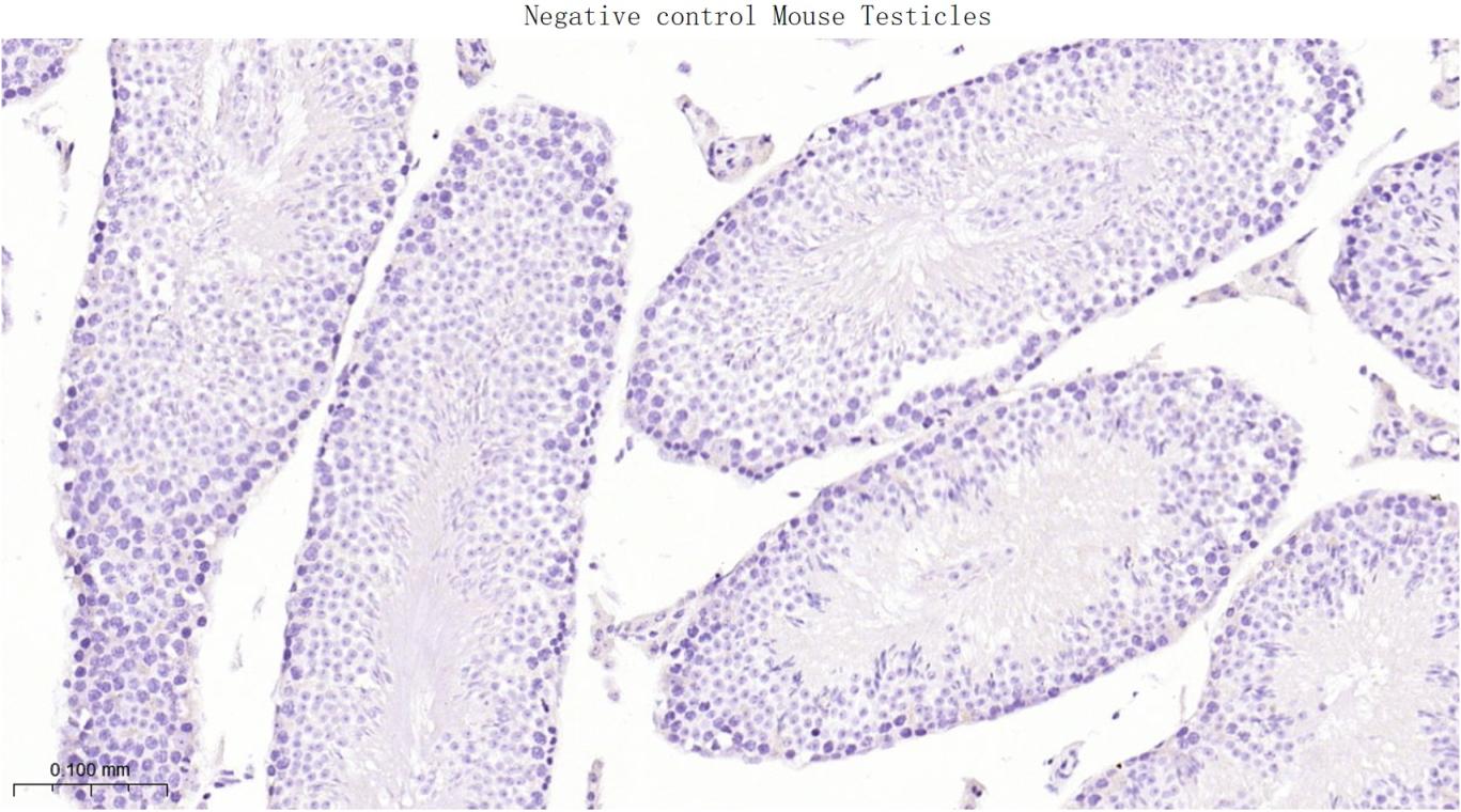 叉头蛋白L2抗体