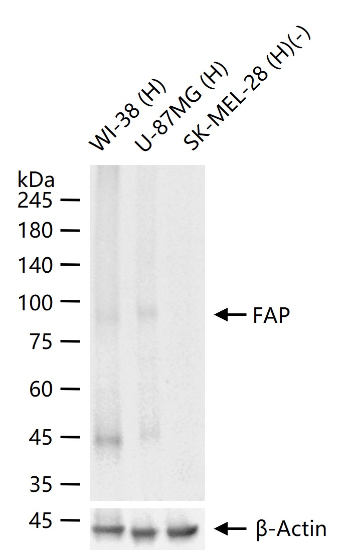 成纤维细胞激活蛋白α重组兔单抗