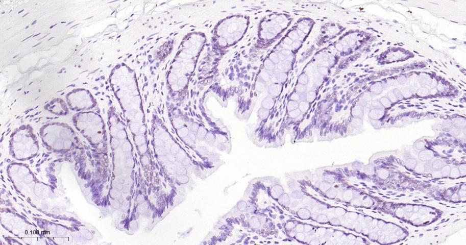DNA结合蛋白2重组兔单抗