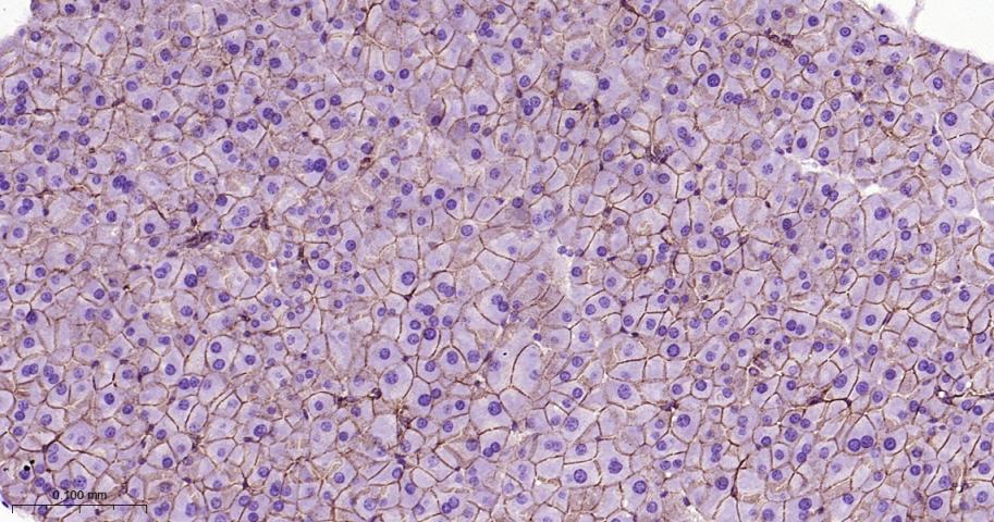 β-连环蛋白/β-连环素/β链接素重组兔单抗