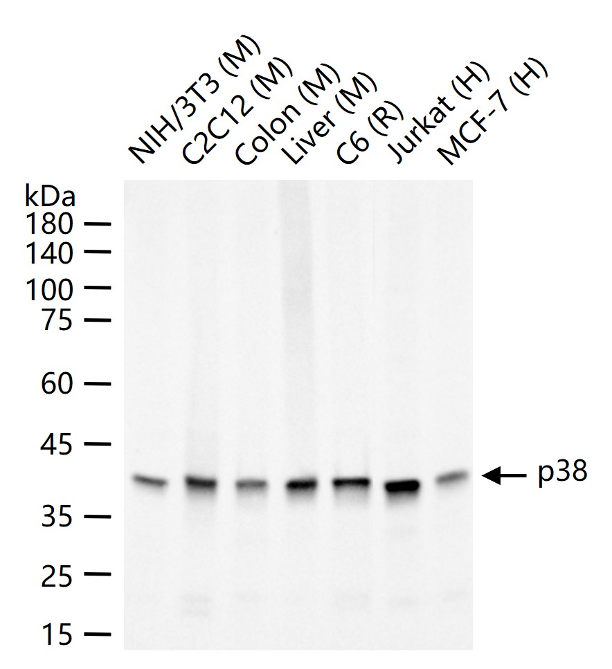 p38 MAPK重组兔单抗