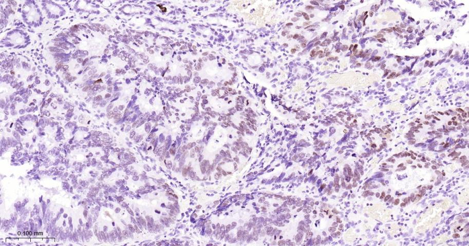 DNA结合蛋白2重组兔单抗