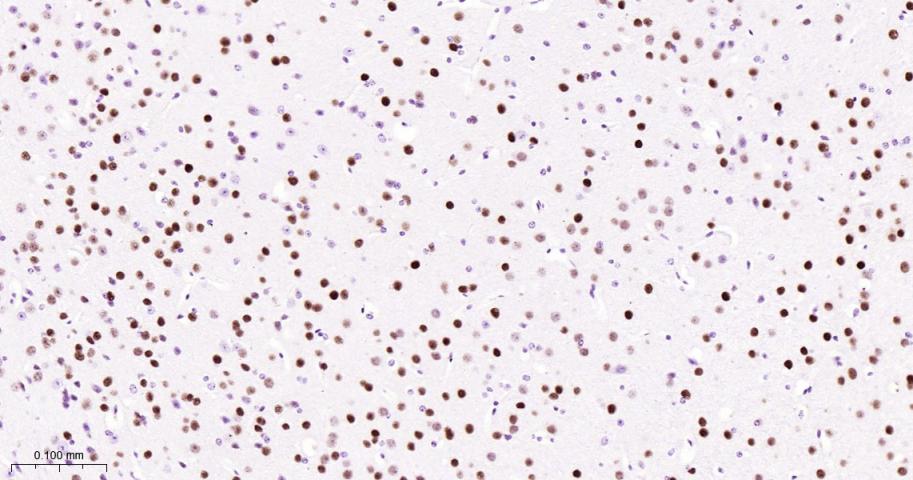 DNA结合蛋白2重组兔单抗