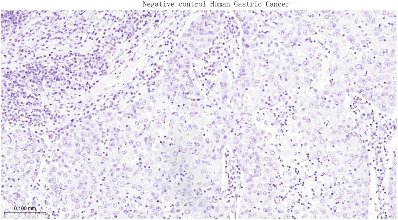 DNA结合蛋白2重组兔单抗