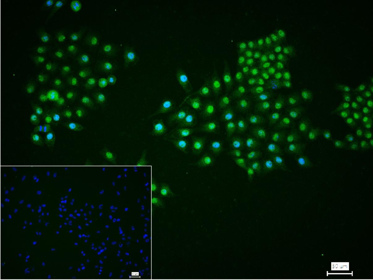 26S蛋白酶调节亚型S5a重组兔单抗-bsm-61859R